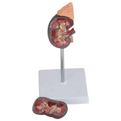 立體器官模型-腎臟